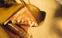 Displaced upper canine tooth