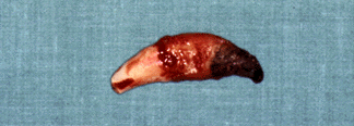 oral