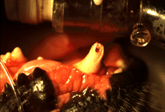 oral