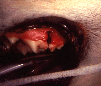periodontal