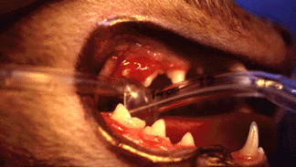 periodontal