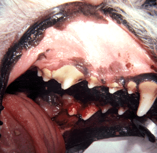 periodontal