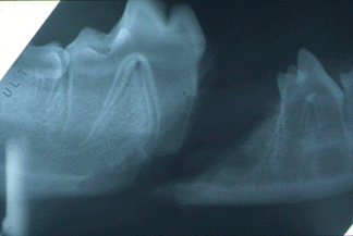 Oral Trauma